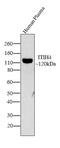 Inter-Alpha-Trypsin Inhibitor Heavy Chain 4 antibody, LF-MA0180, Invitrogen Antibodies, Western Blot image 