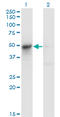 Argininosuccinate lyase antibody, LS-C196699, Lifespan Biosciences, Western Blot image 