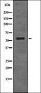 Caseinolytic Mitochondrial Matrix Peptidase Proteolytic Subunit antibody, orb337280, Biorbyt, Western Blot image 
