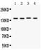 PTC1 antibody, LS-C357542, Lifespan Biosciences, Western Blot image 