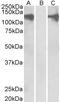 Pumilio RNA Binding Family Member 2 antibody, STJ70674, St John