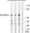 Solute Carrier Family 22 Member 3 antibody, TA314550, Origene, Western Blot image 