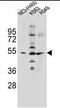 Solute Carrier Family 36 Member 1 antibody, AP39032PU-N, Origene, Western Blot image 
