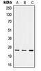 Integrin alpha-7 antibody, LS-C352380, Lifespan Biosciences, Western Blot image 