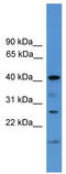 Secretory carrier-associated membrane protein 1 antibody, TA342620, Origene, Western Blot image 