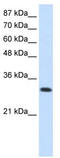 Aminoacyl TRNA Synthetase Complex Interacting Multifunctional Protein 1 antibody, TA345896, Origene, Western Blot image 