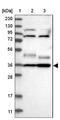 Yip1 Domain Family Member 2 antibody, NBP1-90458, Novus Biologicals, Western Blot image 