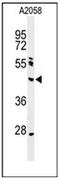 DNA-(apurinic or apyrimidinic site) lyase Neil1 antibody, AP52849PU-N, Origene, Western Blot image 