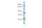 Putative uncharacterized protein C17orf82 antibody, A19039, Boster Biological Technology, Western Blot image 