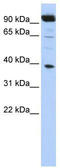 Homeobox B2 antibody, TA339064, Origene, Western Blot image 