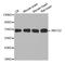 ATP Binding Cassette Subfamily G Member 2 (Junior Blood Group) antibody, STJ27931, St John