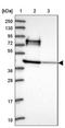 Rho Guanine Nucleotide Exchange Factor 35 antibody, NBP2-46718, Novus Biologicals, Western Blot image 