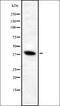 ATPase H+ Transporting V0 Subunit D1 antibody, orb337425, Biorbyt, Western Blot image 