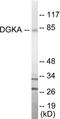 Diacylglycerol Kinase Alpha antibody, EKC1694, Boster Biological Technology, Western Blot image 