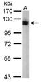 Ubiquitin Specific Peptidase 5 antibody, NBP1-32590, Novus Biologicals, Western Blot image 