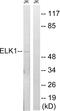 ETS domain-containing protein Elk-1 antibody, LS-C118102, Lifespan Biosciences, Western Blot image 