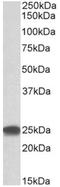 Proteasome Subunit Beta 4 antibody, AP32717PU-N, Origene, Western Blot image 