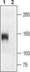 Calcium Voltage-Gated Channel Subunit Alpha1 S antibody, PA5-77362, Invitrogen Antibodies, Western Blot image 