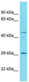 Coiled-Coil Domain Containing 103 antibody, TA334889, Origene, Western Blot image 