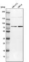 DnaJ Heat Shock Protein Family (Hsp40) Member C14 antibody, PA5-53618, Invitrogen Antibodies, Western Blot image 