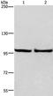 Eukaryotic Translation Initiation Factor 4 Gamma 2 antibody, TA321342, Origene, Western Blot image 