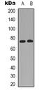 Raf-1 Proto-Oncogene, Serine/Threonine Kinase antibody, orb338977, Biorbyt, Western Blot image 