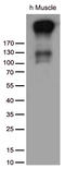 ATPase Sarcoplasmic/Endoplasmic Reticulum Ca2+ Transporting 2 antibody, TA812109, Origene, Western Blot image 