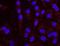 Bromodomain-containing protein 4 antibody, NBP1-18874, Novus Biologicals, Proximity Ligation Assay image 