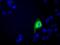 Carnosine N-Methyltransferase 1 antibody, GTX84740, GeneTex, Immunofluorescence image 