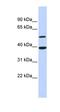 RAC-gamma serine/threonine-protein kinase antibody, orb331424, Biorbyt, Western Blot image 