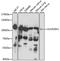 Histone-lysine N-methyltransferase SUV420H1 antibody, LS-C750410, Lifespan Biosciences, Western Blot image 