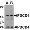 Programmed Cell Death 4 antibody, LS-B1388, Lifespan Biosciences, Western Blot image 