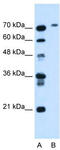 Butyrylcholinesterase antibody, TA334644, Origene, Western Blot image 