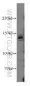 c-met antibody, 19971-1-AP, Proteintech Group, Western Blot image 