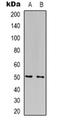 Forkhead box protein N4 antibody, orb319014, Biorbyt, Western Blot image 