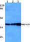 Mitochondrial Ribosomal Protein S35 antibody, A13823S35, Boster Biological Technology, Western Blot image 