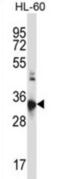 C-C chemokine receptor type 10 antibody, abx027576, Abbexa, Western Blot image 
