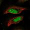 Centromere Protein P antibody, NBP2-58596, Novus Biologicals, Immunofluorescence image 