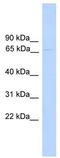 Poly(ADP-Ribose) Polymerase Family Member 6 antibody, TA334270, Origene, Western Blot image 