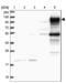 Phosphoinositide-3-Kinase Adaptor Protein 1 antibody, NBP2-38413, Novus Biologicals, Western Blot image 