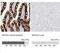 Keratin 20 antibody, NBP1-85599, Novus Biologicals, Immunohistochemistry paraffin image 