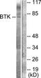ATK antibody, TA313379, Origene, Western Blot image 