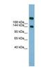 Actin-11 antibody, NBP1-62362, Novus Biologicals, Western Blot image 