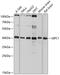 GIPC PDZ Domain Containing Family Member 1 antibody, GTX64641, GeneTex, Western Blot image 