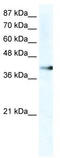 Zinc Finger Protein 556 antibody, TA341404, Origene, Western Blot image 