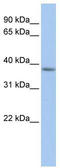 Mitochondrial Fission Factor antibody, TA338407, Origene, Western Blot image 