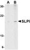 Secretory Leukocyte Peptidase Inhibitor antibody, orb74848, Biorbyt, Western Blot image 