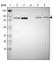 Adenylate Kinase 7 antibody, NBP1-83515, Novus Biologicals, Western Blot image 