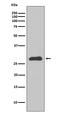 Apolipoprotein A1 antibody, M00717, Boster Biological Technology, Western Blot image 
