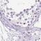 Endoplasmic Reticulum Protein 27 antibody, PA5-62700, Invitrogen Antibodies, Immunohistochemistry paraffin image 